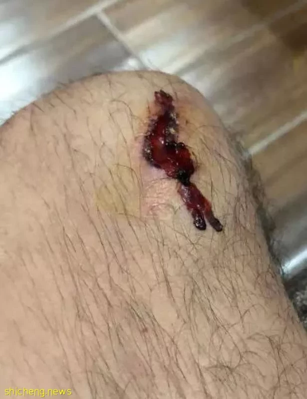 當電影男一 戴向宇拼出傷